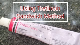 USING TRETINOIN  SANDWICH METHOD [upl. by Templas416]