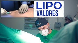 Quanto custa uma lipoaspiração  Valores e preços da lipo e da lipoescultura [upl. by Patten128]