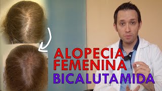 NOVEDAD TRATAMIENTO ALOPECIA MUJER BICALUTAMIDA [upl. by Solegnave11]