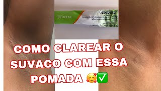 COMO TÔ CLAREANDO MINHAS AXILAS EM CASA  Parte 1 [upl. by Selmore409]