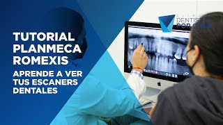 Tutorial Romexis Viewer para Windows y Mac [upl. by Taddeo]