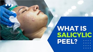 What is Salicylic Acid peel Does it actually work [upl. by Chae]