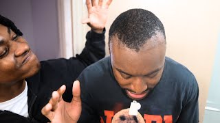 My Family DESTROYED My Hairline Surgery [upl. by Iand]