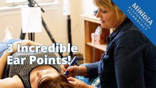 3 Powerful Ear Acupuncture Points that Enhance any Treatment [upl. by Griselda773]