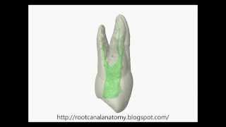 ThreeRooted Maxillary Premolar  Prof Marco Versiani [upl. by Dlonra393]