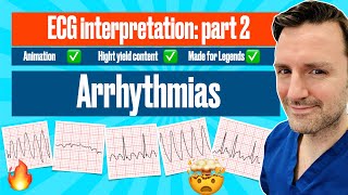 Arrhythmias A Visual Guide with ECG Criteria ecgmadeeasy [upl. by Gregg808]