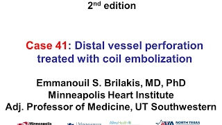 Case 41 Manual of CTO interventions  Distal vessel perforation treated with coil embolization [upl. by Lorien]