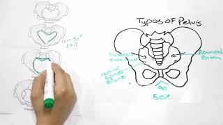 Types of Pelvis [upl. by Lebaron]