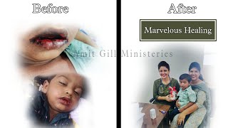 Marvelous Healing By Jesus Christ ✨✝️  Amit Gill Ministeries Presents [upl. by Okimuk]