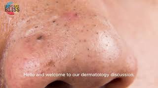 Say Goodbye to Blackheads The Power of Dermatology can dermatologist remove blackheads [upl. by Elbys81]