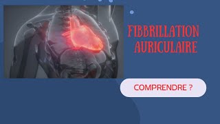 Comprendre la Fibrillation Auriculaire Explications et Exemples [upl. by Kiraa]