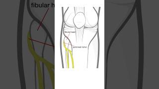 Foot Drop  L5 radiculopathy vs peroneal nerve injury [upl. by Garland]