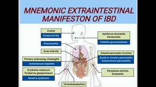 MNEMONIC EXTRAINTESTINAL MANIFESTON OF IBD medicinelectures medicineeducationtalks [upl. by Esinehc]