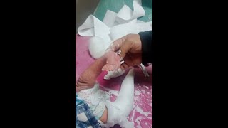 best ponseti technique for clubfoot  Best Ponseti tricks in clubfoot part 2 [upl. by Thgiled425]