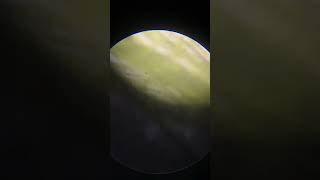 Spirogyra under microscope youtubeshorts viralvideo viralshorts recommended [upl. by Kenon]