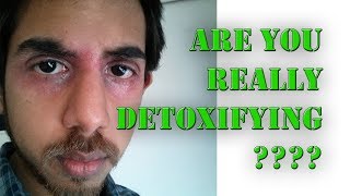 TWO Types of Eczema Healing Detoxification [upl. by Airamas758]