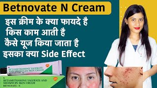 Betamethasone Valerate and Neomycin Skin Cream  Betnovate N Cream for Face  Uses [upl. by Lantz]