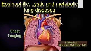 9Eosinophilic  cystic and metabolic lung diseases [upl. by Hancock283]