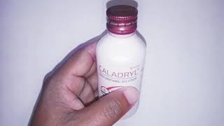 Caladryl Skin Soothing Solution Skin Allergy Expert Lotion [upl. by Hoskinson]