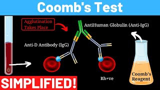 Indirect and direct Antiglobulin test Coombs test  direct and indirect  Panmedicad [upl. by Papageno]