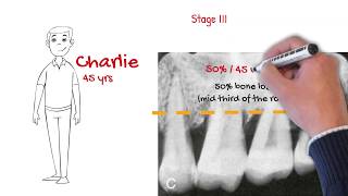 The new periodontal classification MUST WATCH FOR ALL DENTISTS [upl. by Perkoff579]