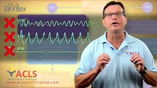 ACLS Adult Cardiac Arrest Algorithm  PEAAsystole [upl. by Sedecram]