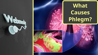 What Causes Constant Phlegm Mucus in Throat [upl. by Eveam]