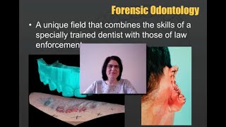 Forensic Odontology [upl. by Akerue]