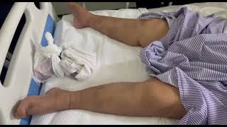 Tone Examination Lower Limb For Hypotonia  Lower Motor Neuron Lesion [upl. by Rochell687]