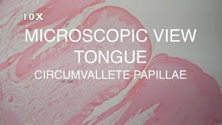 MICROSCOPIC VIEW  TONGUE CIRCUMVALLATE PAPILLAE [upl. by Wira951]