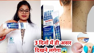 Wart Remover Ointment honest review 2023Wart Remover Ointment benefit usesampsideeffects review hindi [upl. by Sadoff]