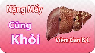 Viêm Gan B Và Viêm Gan C Với 3 Bài Thuốc Kết Hợp  Bác Hùng Y [upl. by Amat228]