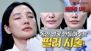 나이 들어보이는 인상 동안얼굴이 되고 싶다면 대구피부과에서 필러로 볼륨감up 👆 [upl. by Hagerman]