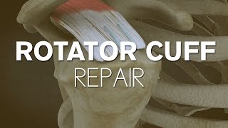 What happens during a rotator cuff surgery [upl. by Wiseman]