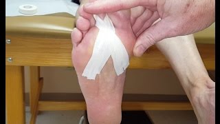 Plantarflexion Taping for Plantar Plate Tears [upl. by Alrahc193]