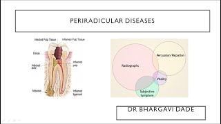 Periradicular DiseasesINBDEBDSMDS [upl. by Oreves]