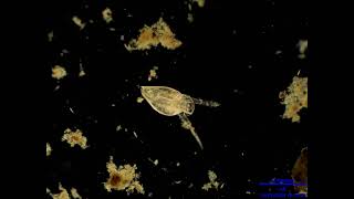 Water Flea in Brightfield and Darkfield [upl. by Holmann]