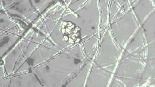 Pythium zoospore discharge [upl. by Estren]