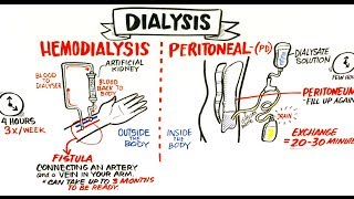 Failing Kidneys and Different Treatment Options [upl. by Tybi]