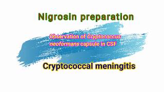 Cryptococcal meningitis observation of Cryptococcus neoformans capsule in nigrosin preparation [upl. by Icnarf256]