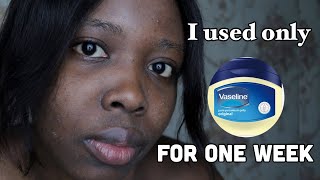 I used only VASELINE on my face everyday for 7 days and this is what happened [upl. by Xella]