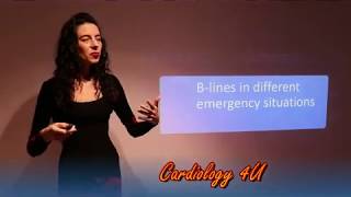 Blines in lung ultrasound [upl. by Marybella]