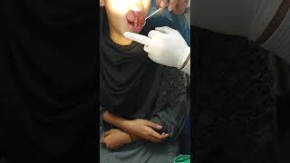 Root Canal Opn And infected Toothwarm please Channel ko Subseribe kre [upl. by Kee]