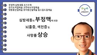 부정맥 심방세동 조기수축 항부정맥제 베타차단제 칼슘길항제 디곡신 항혈전제 항응고제 항혈소판제 전극도자절제술 고주파도자절제술 냉동풍선절제술 냉각풍선절제술 부정맥시소탕 창원동양한의원 [upl. by Dickenson465]