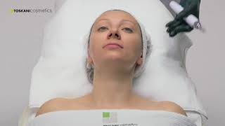 TOSKANI Mesotherapy Facial Treatment Demonstration using Dermapen [upl. by Vivica]