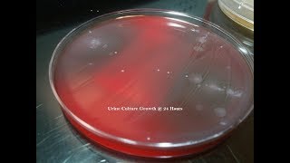 Urine Culture Colony Growth with Multiple Bacteria [upl. by Sioux]