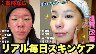 【垢抜け】ニキビ肌からNOトラブル肌になったリアル毎日スキンケアを案件なしで全部見せ！【スキンケア編】 [upl. by Ellita812]