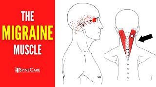 How to Release Tension for FAST MIGRAINE RELIEF [upl. by Gnus]