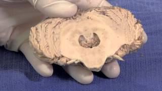 The Cerebellum Neuroanatomy Video Lab  Brain Dissections [upl. by Folsom216]