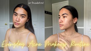 natural everyday acne makeup routine for acne textured skin amp post inflammatory pigmentation [upl. by Lacombe414]